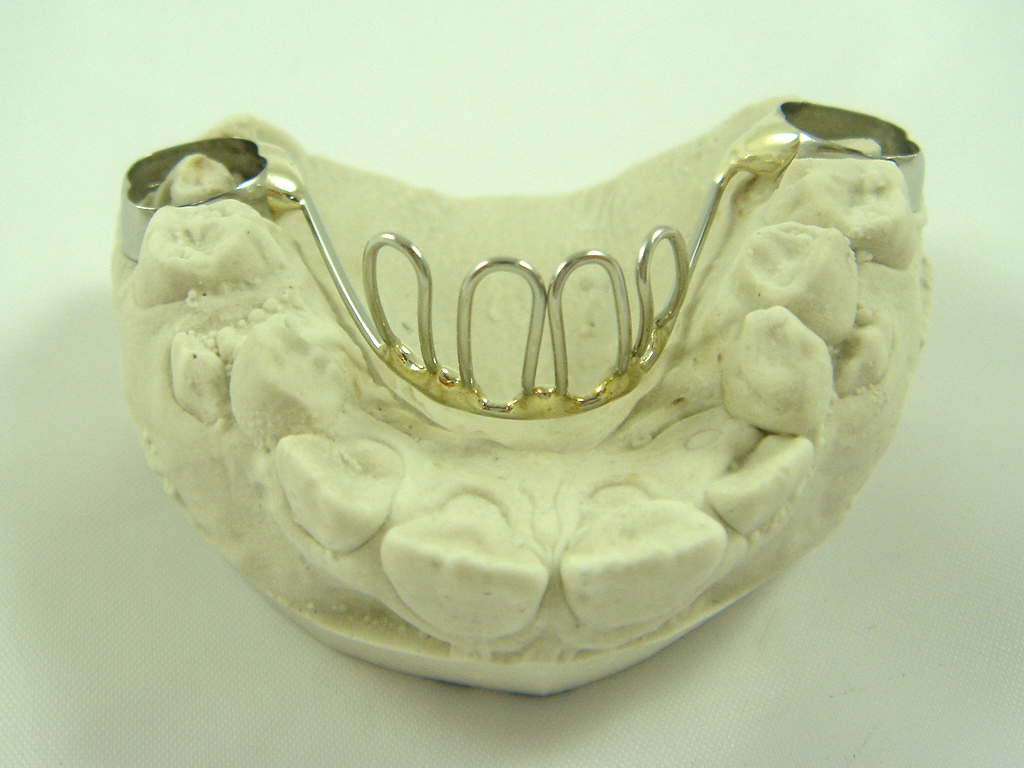 Re Braces. Page 3 BeautyTalk