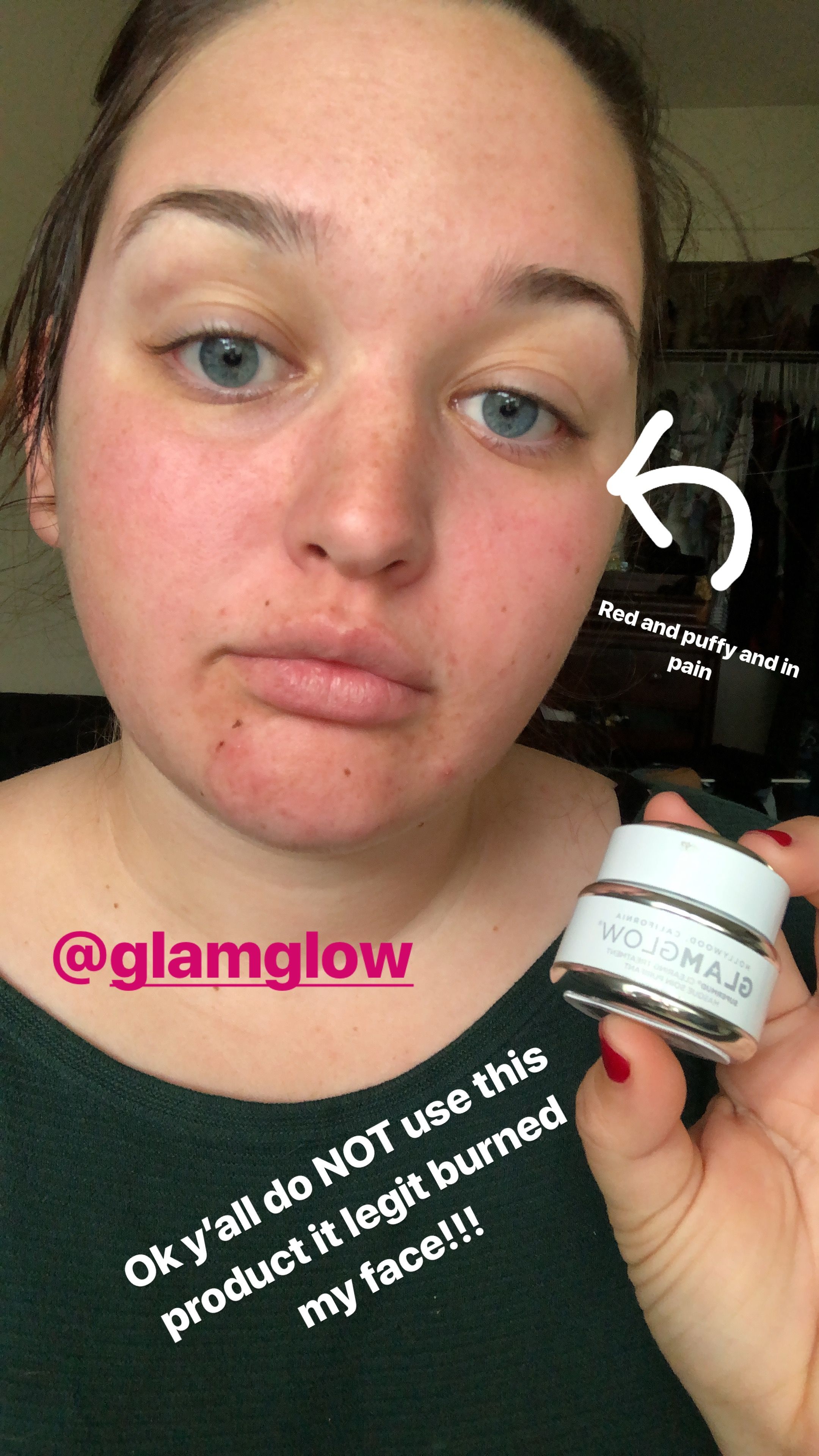 Is Glam Glow Supermud supposed to burn/t... - Insider