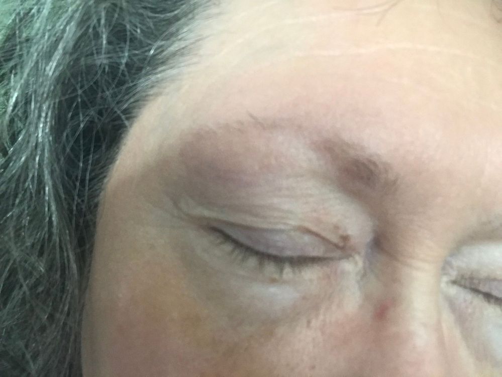 My naked spotty brows (and naked face, too)