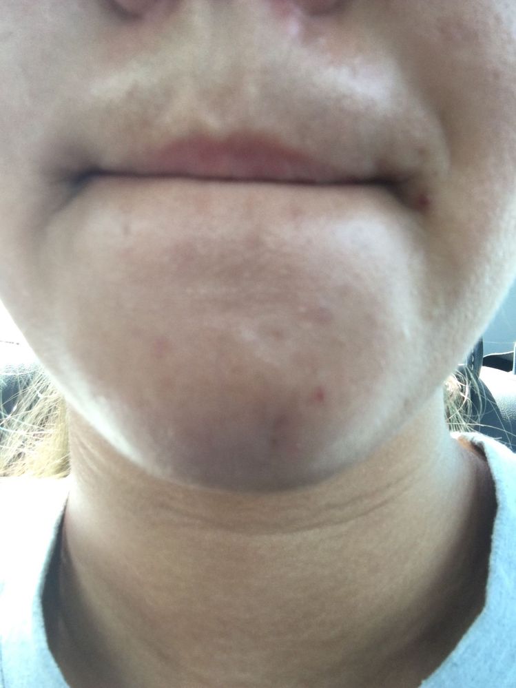 cleanser dries out my skin