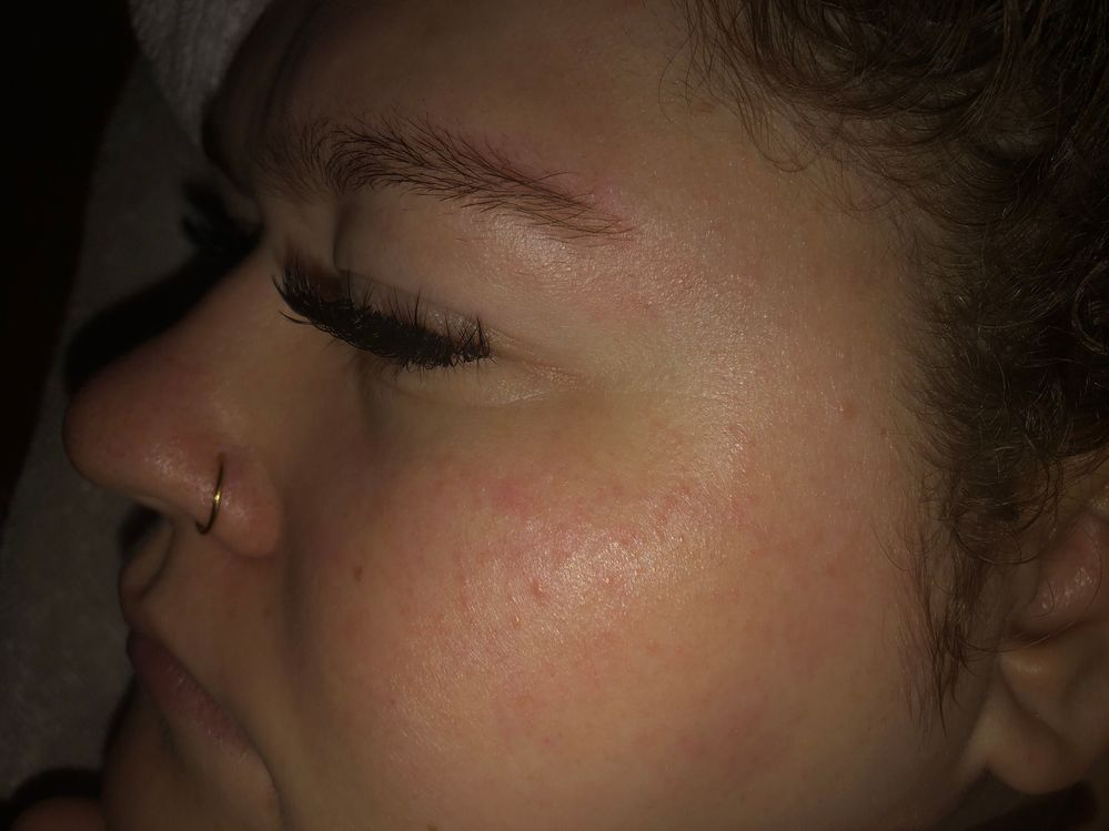 best moisturizer for tiny bumps