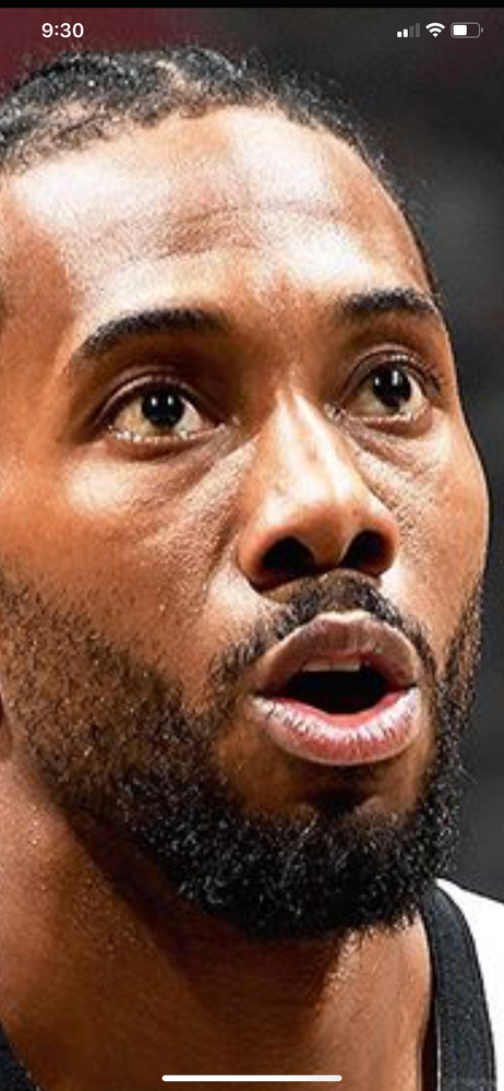 NBA ALL-PRO Kawhi Leonard. Note: visible glands under his eyes.