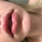 12 hrs after discontinued use