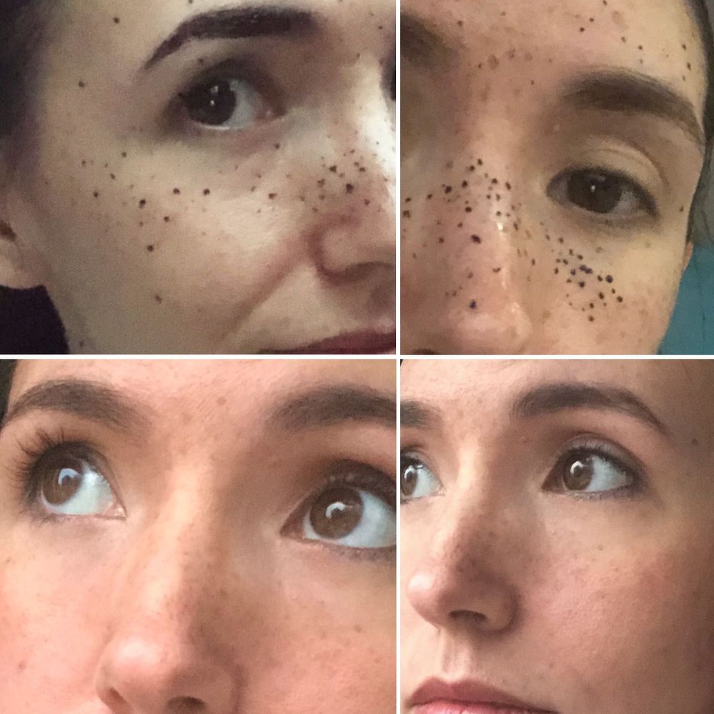 fake freckles? - Beauty Insider Community
