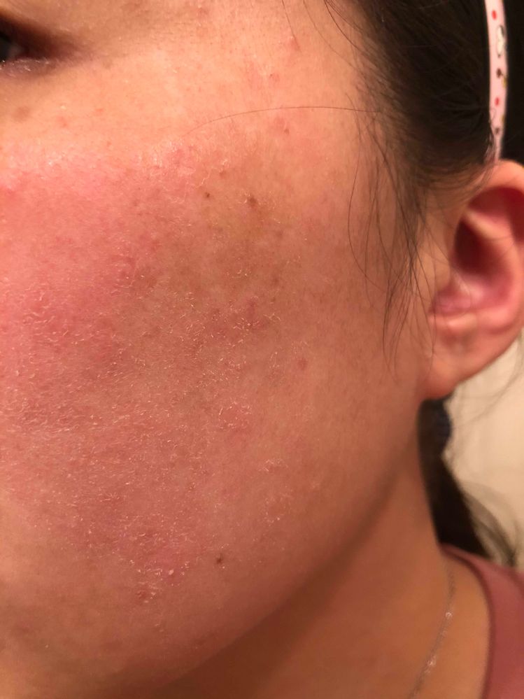 my skin needs help