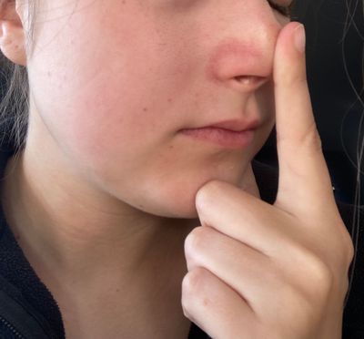 The skin next to my nose is red - Beauty Insider Community