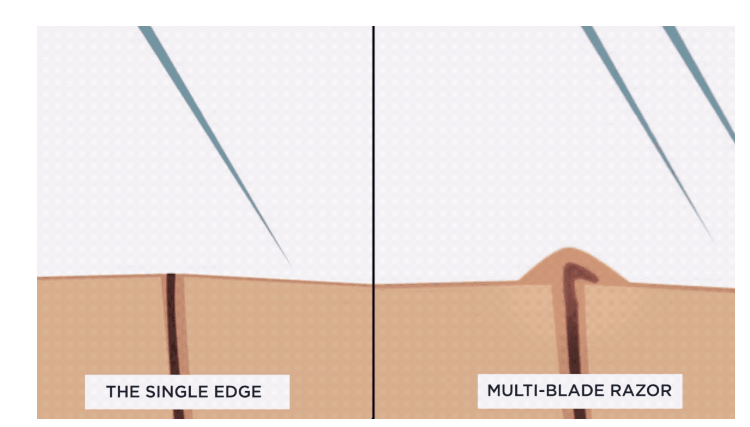 Do NOT use a multi-blade razor, it will irritate you !