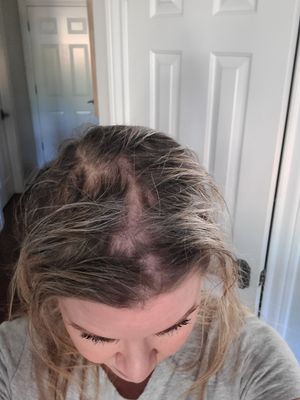 Re: Olaplex 3 and hair loss? - Page 19 - Beauty Insider Community
