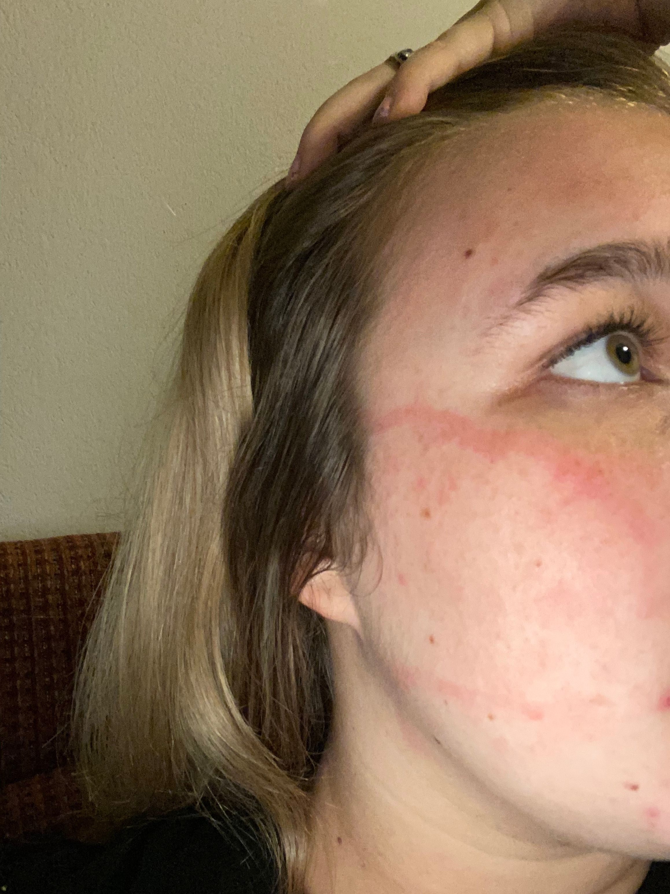 Re: Olaplex 0 - allergic reaction? - Page 2 - Beauty Insider Community