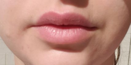 bare lips