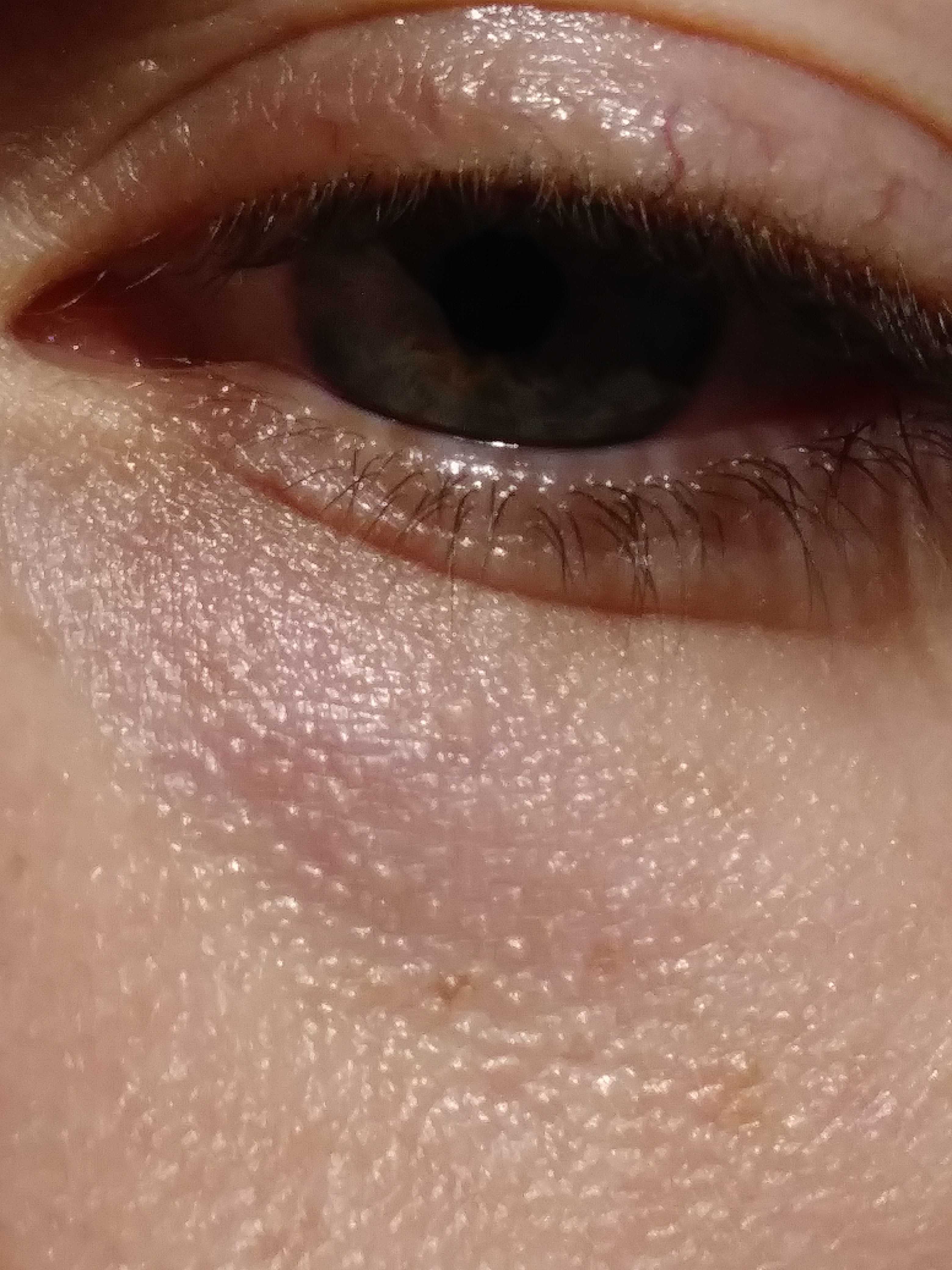 Can I use salicylic acid/BHA to exfoliat... Beauty Insider Community