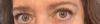 Both eyes two coats