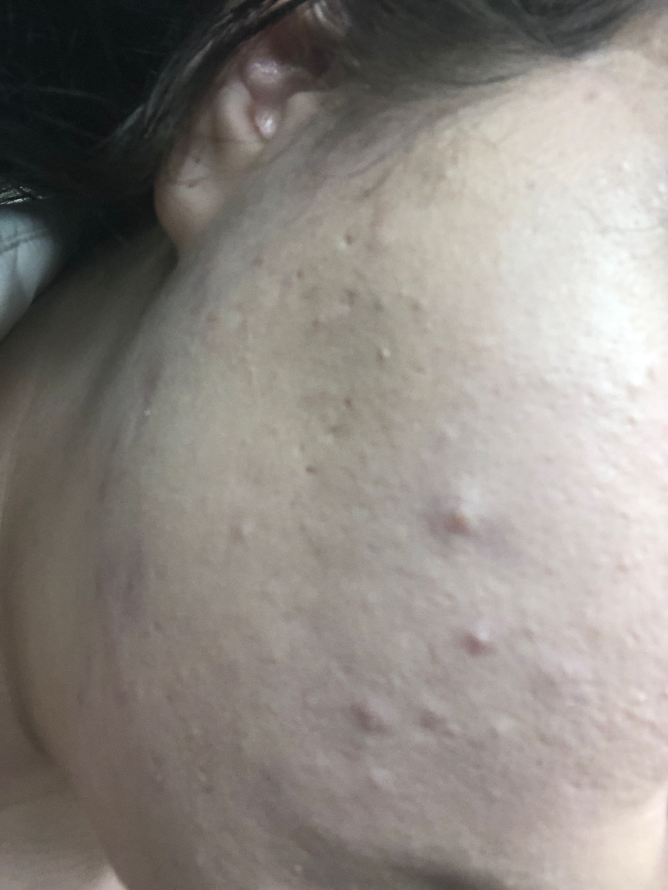 Foundation not sticking and face having Beauty Insider Community