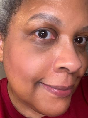 NARS Orgasm Edge on just one cheek. (Yes, I know my nose is red. Hooray surface redness + nose-blowing irritation!) Any yellow/gold you see is from a nearby warm light I forgot to turn off before taking this photo.