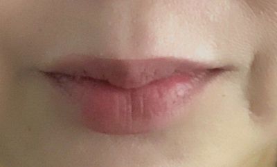 These are my bare lips, after Rhode unscented (and untinted) lip treatment applied and absorbed, skincare and makeup (except for lips).