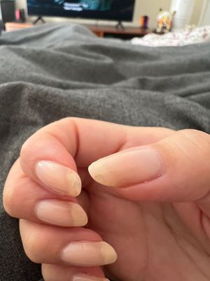 After 1 week of wear