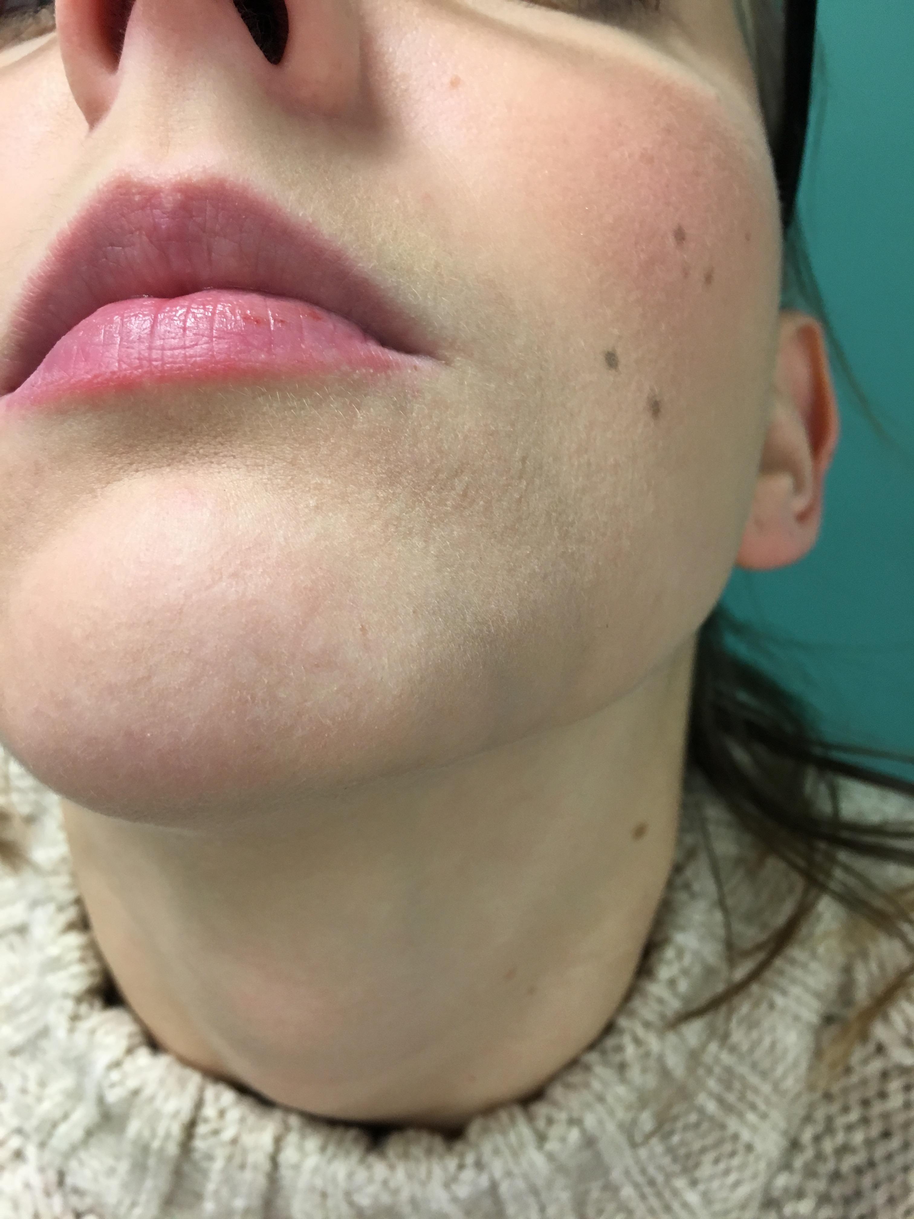 chin.jpg