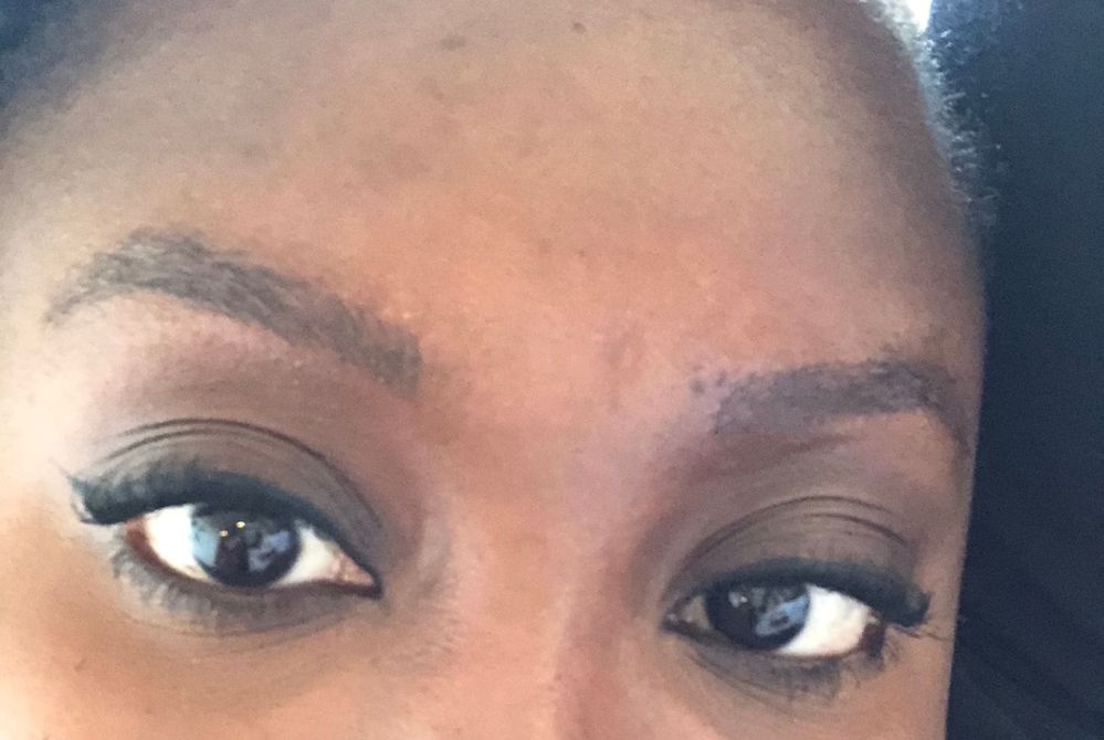 Immediately after the procedure